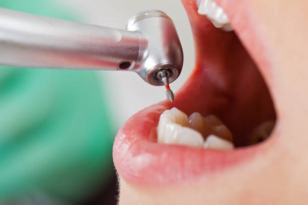 Best Emergency Denture Repair in Arlington, VA